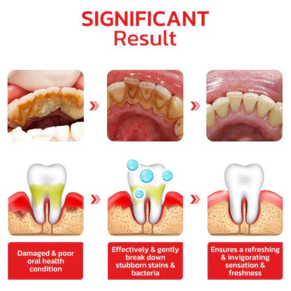 Whitening Toothpaste instant results (Pack of 2)